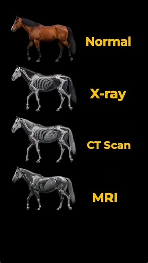 X-ray vs CT vs MRI: What's the Actual Difference???