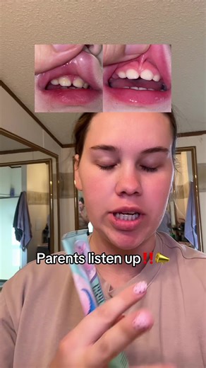 This kids toothpaste with no fluoride worked wonders on my toddlers teeth!! #creatorsearchinsights #kidsoralcare #kidstoothpaste #nofluoride #oralhealth