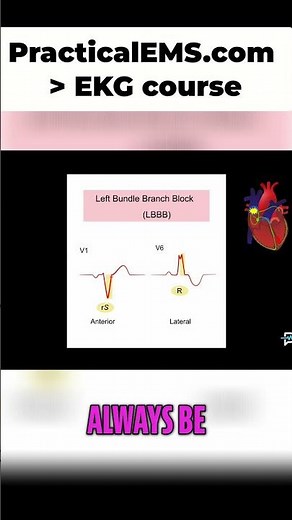 LBBB vs RBBB: ECG Interpretation Made Easy!
