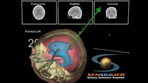 Ponction ventriculaire et dérivation ventriculo-péritonéale