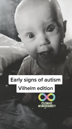 Understanding Stimming: Sensory Seeking in Autistic Individuals