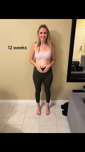 Triplet Pregnancy Journey: My Belly Evolution Story