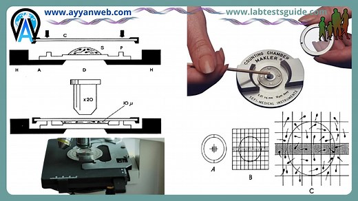 Makler Counting Chamber | Lab Tests Guide