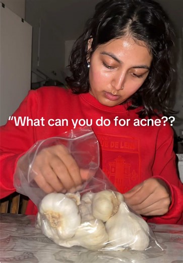 Discover the Power of Garlic for Acne Treatment