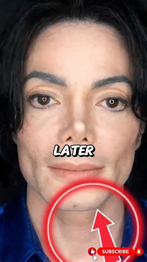Michael Jackson's Plastic Surgery Timeline: What Really Happened?#michaeljackson #viral #shorts
