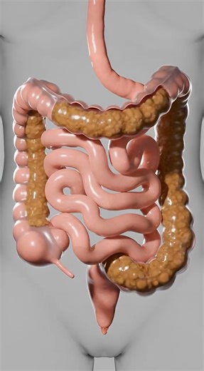 How Poop Is Formed Inside Your Body 💩 | 3D Animation #shorts #viralvideo #poop #DigestiveSystem