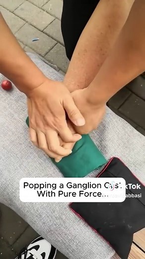 Understanding Ganglion Cysts and Their Treatments