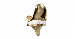 MicroPort Orthopedics Announces Launch of its Evolution® NitrX™ Medial-Pivot Knee System