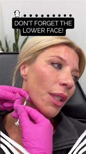 Don't Forget the Lower Face