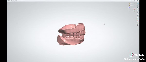 Innovations in Digital Dentistry: Removable Dentures Explained