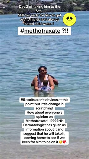 Eczema Healing Journey: Methotrexate Opinions Needed