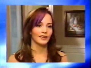 Chin Implant Augmentation Before and After