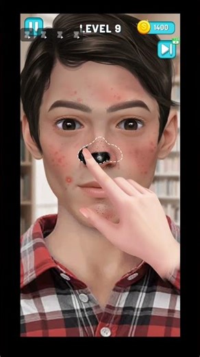 Geek Boy Glow Up! 🤓✨ Glasses Guy Face Cleaning Transformation! #beforeafter #beforean #makeup #asmr