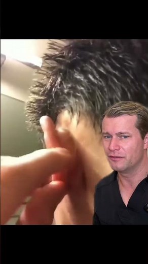 Big juicy ear cyst! #cyst #pimple #pop #fyp #explosion