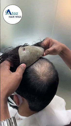 Men Hair Patch in Delhi | Clip System Human Hair Patch