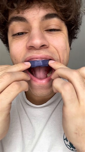 Comment avoir des dents blanches facilement ?