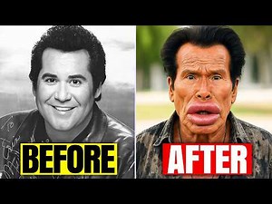 Most UNBELIEVABLE Plastic Surgery of Male Hollywood Celebrities (Before and After)