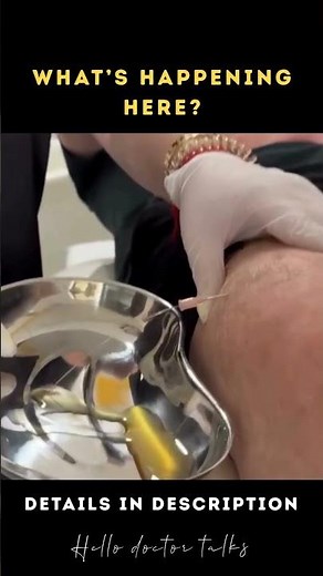 What's Happening here 😮🤔 #healthchannel #doctorslife #askdoctor #askdoc #askus #doctor #medical