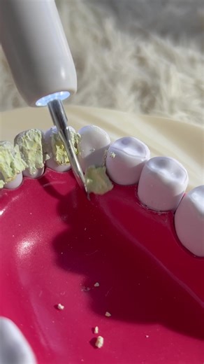 Ultrasonic Teeth Cleaner for Effective Tartar Removal