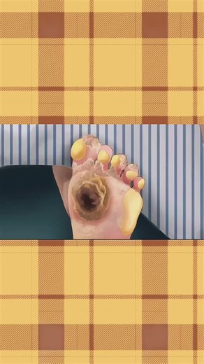 foot treatment cleaning Asmr animation #foot #teatment #cleaning #asmr #vairalvideo