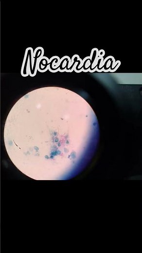 NOCARDIA in microbiology . Nocardia are aerobic, Gram-positive bacteria