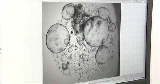 New technologies help Lustgarten Foundation learn more about pancreatic cancer