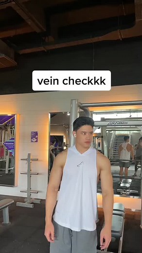 Understanding Vein Health: What Is a Vein Check?