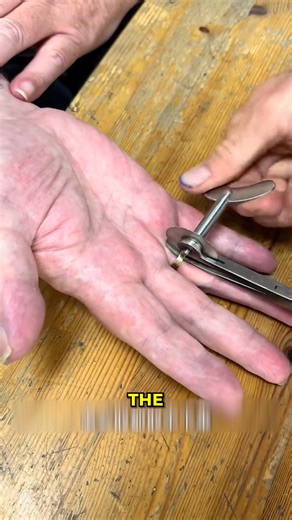 Splinter Removal Tool. #MedicalDevice #HandCare | Gizmo Trends