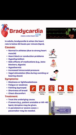 Bradycardia Causes,Symptoms and Treatment 🫀🧐🩺👇👇👇👇👇👇 #heartproblems #healthcare #healtheducation #MedicalEducation #nursing #NurseLife #Bradycardia #nurses #fypageシ #nursingstudent | Ma Vickie