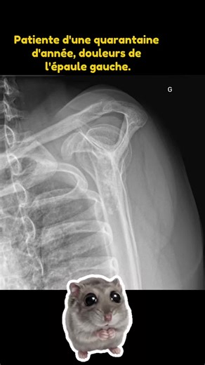 Simple. Basique : Qu'est-ce que c'est? Dr Antoine Kirchner #radiology #mri #doctor #doctorsoftiktok