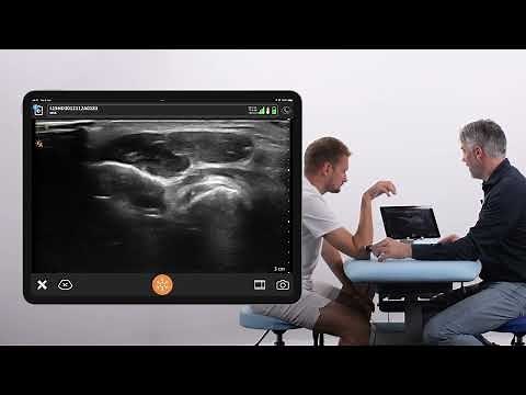 Scanning the Distal Biceps Tendon: Dorsal Approach