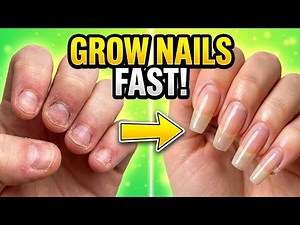 Grow Nails Fast Naturally 💅 | #Easy Nail Growth Tips at Home | #Long Strong Nails