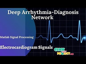 Matlab Signal Processing Deep Arrhythmia-Diagnosis Using Electrocardiogram Signals ClickMyProject