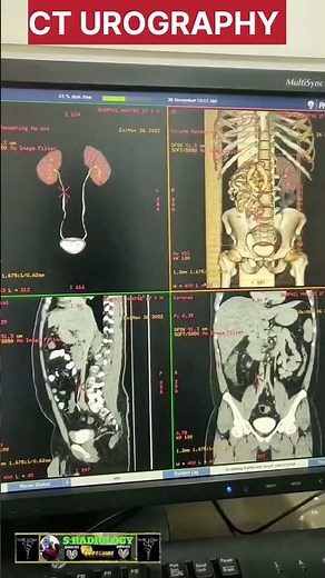 CT SCAN UROGRAPHY #RADIOLOGY #RADIOGRAPHER
