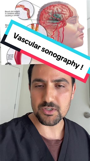 Vascular technologists plays crucial role in improving circulation and . #vascular #ultrasound #ultrasoundtech #fyp #kabikoirala