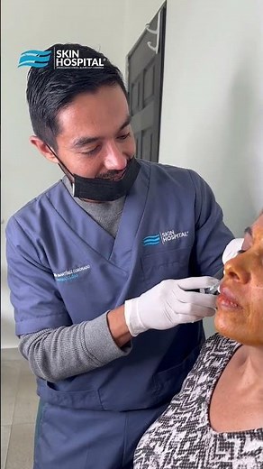 Aplicación de relleno en rostro restylane defyne | Skin hospital | #filler