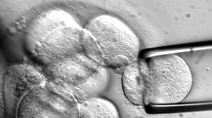 A Short History of Stem Cell Research