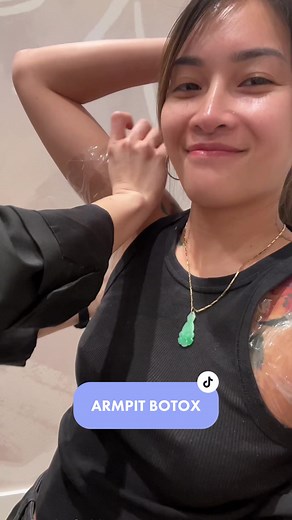Armpit Botox is officially an essential service i get done now. Can’t live without it! @Peng Yin from @REJUUV YORKVILLE is MY GIRL. #botox #underarmbotox #hyperhidrosistreatment #bodyodorsolution