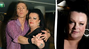 E-type-sångerskan Nana Hedins käke förstörd efter cancer – vädjar: ”Värsta de sett”