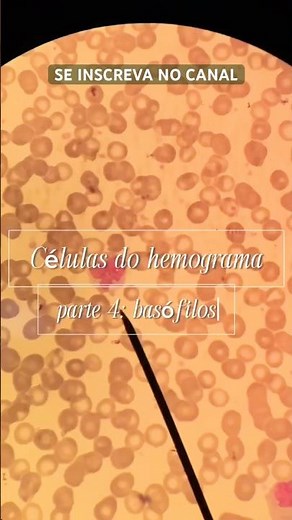 🩸🔬 Learn about BASOPHILS #biomedicine #hematology #cells