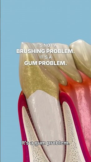 Gum Bleeding While You Brush? Here's What It Really Means