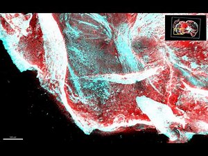 Mouse Brain - Coronal Section