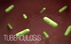 Tuberculosis (TB) Transmission and Pathogenesis