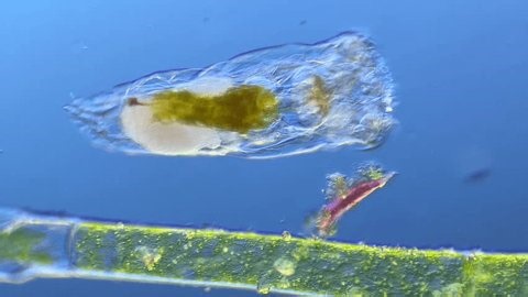 clip-3998875187-epiphanes-rotifer-under-microscope-100x-magnification