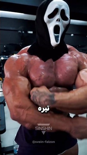 21-Year-Old Bodybuilder’s Appearance Alarms Everyone! What Is the Truth Behind These Signs? 😳🏋️#s...