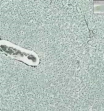 Shotgun Histology Liver Reticulin Fibers