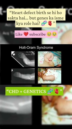 Congenital Heart Disease 🫀 | Genetic Factors Explained