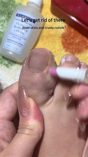 Winter Nail Care: Softening Dry Cuticles