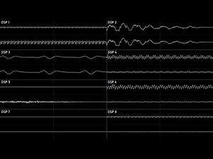 Yoshi's island: Flower Garden Oscilloscope view