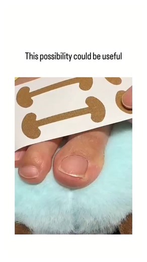 Trend Meme on Instagram: "The post features a 28-second video tutorial showing how to apply gold mesh tape around toes to create custom separators, likely for aligning overlapping toes and preventing discomfort during pedicures or daily wear. , a verified Indonesian content creator with over 3,600 followers, it received quick engagement with 195 likes and 158 replies, many in Indonesian highlighting its practicality for avoiding foot pain. Podiatry research, including a 2018 PubMed study, suppor